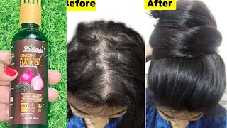 Onion Black seed hair oil review  Onion Black Seed hair Oil benefits  Onion black seed hair oil [upl. by Solokin]