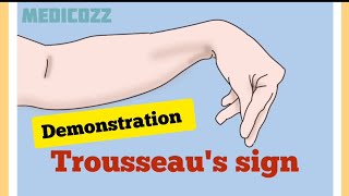 Trousseaus sign in Hypocalcemia  Patient video  causes treatment prevention [upl. by Lerat]