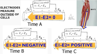 Electromyography EMG Biopac lecture [upl. by Earl]