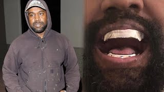 Kanye Wests SelfDesigned Teeth Cost Leaves Mouths Agape [upl. by Anallise]