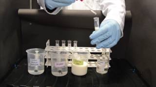 Normal Range of Routine Blood Tests biochemistry labtests pathologylab [upl. by Prue]