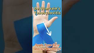 De Quervains Tenosynovitis Tape For INSTANT relief thumbpain wristpain kinesiotape [upl. by Alac]