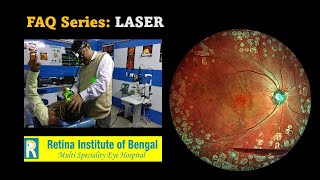 The FAQs Series Retinal LASER [upl. by Yanttirb]