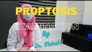 Proptosis Examination [upl. by Ahsinel]