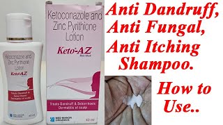 KetoAZ LotionShampoo BenefitsUsesSide Effects  Ketoconazole  Zinc Pyrithione 🔥🔥 [upl. by Aixela]