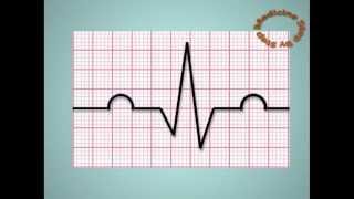 Understanding ECGs  EKG [upl. by Otrebogir]