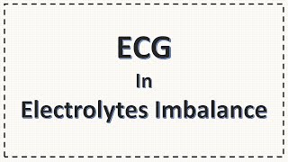 Electrolytes Imbalance and ECG changes  Hypokalemia Hyperkalemia Hypocalcaemia Hypercalcaemia [upl. by Aihceyt103]