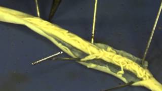 Roundworm dissection [upl. by Scales4]