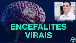 ENCEFALITES VIRAIS NA TC E RM [upl. by Nnaael649]