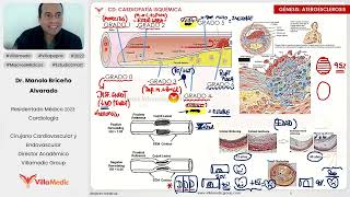 Residentado Villamedic Cardiología CARDIOPATÍA ISQUÉMICA fisiopatologíaSICASICASTESd TakoTsubo [upl. by Urbano766]