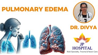 Pulmonary Edema Symptoms Cause and Medication  Dr Divya  JP Hospital [upl. by Orlina]