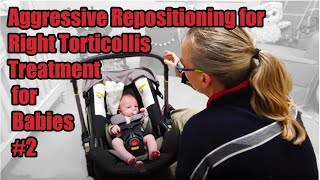 2R Aggressive Repositioning Right Torticollis Treatment Torticollis Treatment in Babies [upl. by Ariamo]