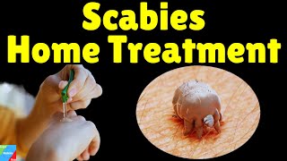 Scabies Home Treatment  Home Remedies for Scabies to Speed Up Treatment  How to Treat Scabies [upl. by Nnaeirrac687]