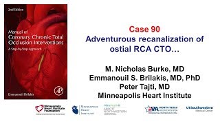 Case 90 Manual of CTO Interentions Adventurous ostial RCA CTO recanalization [upl. by Ase901]