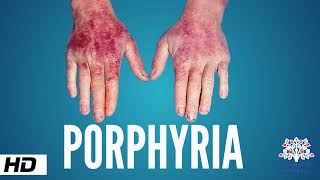 Porphyria Causes Signs and Symptoms Diagnosis and Treatment [upl. by Lehman157]