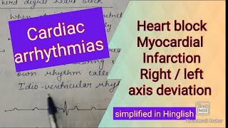 Cardiac arrhythmia  Applied aspect of ECG [upl. by Cressi]