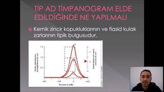 ODYOLOJİDE TİMPANOMETRİK TESTLER VE DEĞERLENDİRİLMELERİ [upl. by Cara]