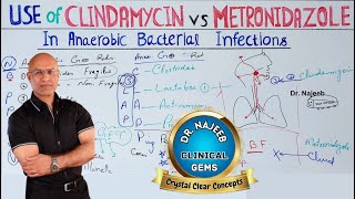 Clindamycin vs Metronidazole  Anaerobic Infection  Pharmacology💊 [upl. by Atwahs]