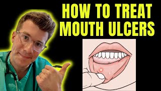 How to recognise and treat Mouth Ulcers getting rid of canker sores  Doctor ODonovan explains [upl. by Zednanref]