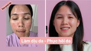 Làm dịu da sau nặn mụn Peel  Phục hồi da nhạy cảm Kem dưỡng ẩm Klairs Midnight Blue Calming Cream [upl. by Desirea]