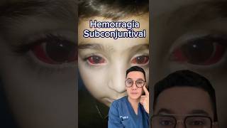 Sangre en el ojo hemorragia subconjuntival  Dr William Guerrero medicina shorts [upl. by Keavy332]