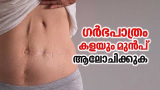 ഗർഭപാത്രം കളയും മുൻപ് ആലോചിക്കുക  Uterus Removal  Uterus Problem [upl. by Avle]