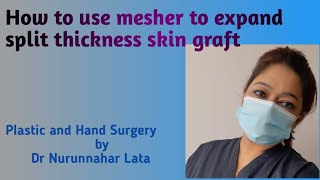 How to use mesher to expand split thickness skin graft [upl. by Mayfield671]