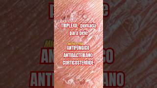 Triplexil clotrimazole batametasona gentamicina pomada cuidadoscomapele antifugico Saude [upl. by Seabrooke]