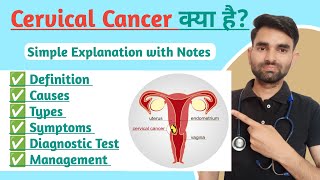 Cervical Cancer in Hindi  Types Causes Symptoms And Treatment of Cervical Cancer [upl. by Kendrick]