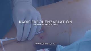 Radiofrequenz der Stammvene Vena Saphena Magna Minimalinvasive Venen Operation Varizen [upl. by Bron]