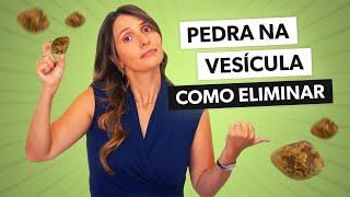 Pedra na vesícula principais sintomas e alimentação ideal [upl. by Pyotr]