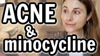 Minocycline versus doxycycline for acne Dr Dray [upl. by Rowney]