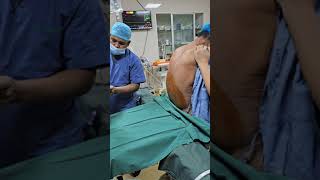 Spinal Anaesthesia for Low Cardiac Reserve patient low EFanesthesia spinal [upl. by Eikcir]