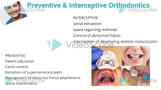 Preventive and interceptive orthodontics [upl. by Yalhsa]