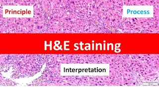 HE Staining Principle Procedure and Interpretation  Haematoxylin and Eosin Staining [upl. by Battat]