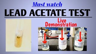 Lead acetate test  Test for sulfur containing amino acids  Biochemistry  NEETPG [upl. by Cosimo]