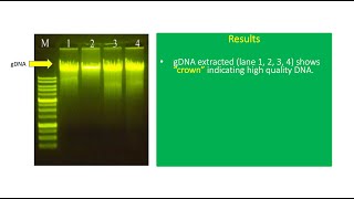 How To Interpret Extracted DNA Result In Agarose Gel 🧬 [upl. by Albur]