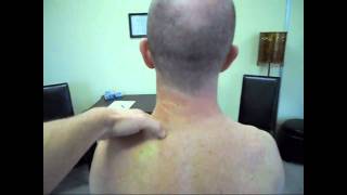 Neck Strain fixed with two Manual Therapy treatments [upl. by Mandler]