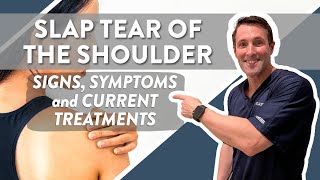 SLAP tear of the shoulder Signs symptoms and current treatments [upl. by Odraner]