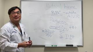 Retinal hemorrhages [upl. by Cob]