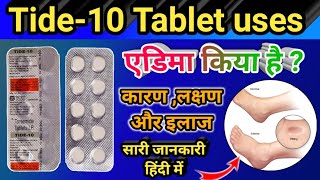 Tide10 Tablet use in hindi  Tide10 की पूरे जानकारी हिंदी में एडिमा रोग की बेस्ट टेबलीट्स 🔴 [upl. by Refinneg]