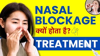 Nasal Blockage Treatment At Home  Nasal Polyps Kyu Hota Hai [upl. by Mae]