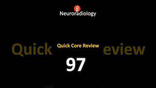 Buzzword Neuro Core Exam Case 97 [upl. by Lathrope584]