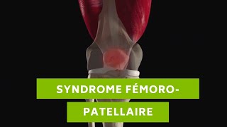 Le syndrome fémoropatellaire cest quoi   Nxt Generation PHYSIO [upl. by Araes315]