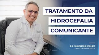 Tratamento da Hidrocefalia Comunicante com Válvulas de Derivação  Dr Alexandre Canheu [upl. by Aborn]