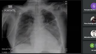 Fisiopatología de la insuficiencia cardiaca Izquierda y Cor Pulmonale UNIDAD III [upl. by Nabe636]