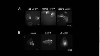 Role of Catenins in Cell Migration [upl. by Mahau]