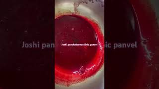 ayurveda vitiated blood Emesis of blood post hirudotherapy Rakthdosh Rakthduddhi Detox Blood [upl. by Chil]