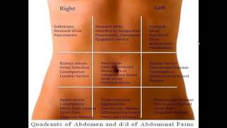 Differential diagnosis of abdominal pain according to abdominal regions [upl. by Aislehc]