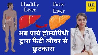 अब पाये होम्योपैथी द्वारा फैटी लीवर से छुटकारा Now get rid of fatty liver with homeopathy [upl. by Tare]